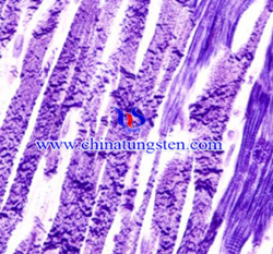 Ácido fosfotúngstico Hematoxilina Imagem de tingimento
